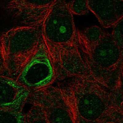 Immunocytochemistry/ Immunofluorescence: NOL9 Antibody [NBP2-55353]