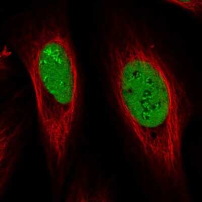 Immunocytochemistry/ Immunofluorescence: NOLA1 Antibody [NBP2-31742]