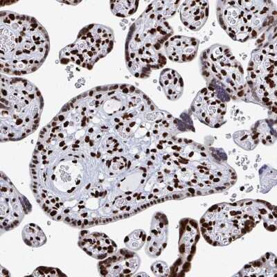 Immunohistochemistry-Paraffin: NOLA1 Antibody [NBP2-31742]