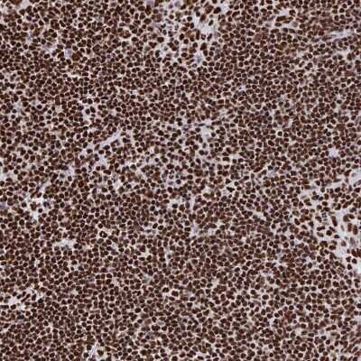 Immunohistochemistry-Paraffin: NOLA1 Antibody [NBP2-31742]