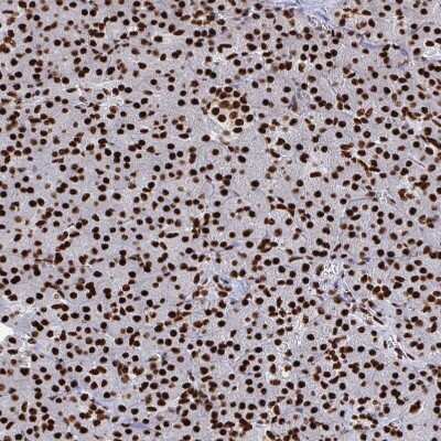 Immunohistochemistry-Paraffin: NOLA1 Antibody [NBP2-31742]