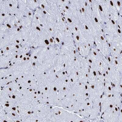 Immunohistochemistry-Paraffin: NOLA1 Antibody [NBP2-31742]