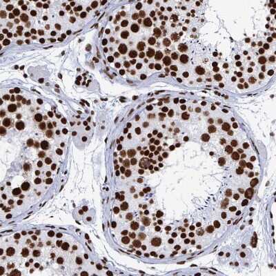 Immunohistochemistry-Paraffin: NOLA1 Antibody [NBP2-31742]