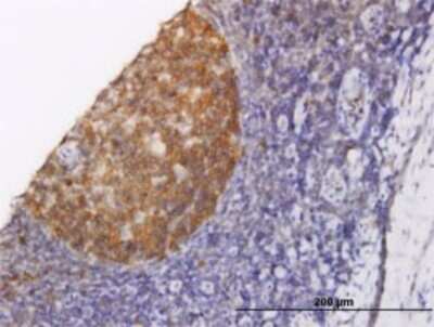 Immunohistochemistry-Paraffin: NOLC1 Antibody (6B4) [H00009221-M02]
