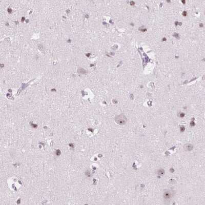 Immunohistochemistry: NOLC1 Antibody [NBP2-38625]