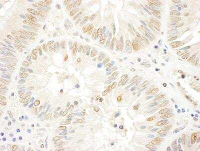 Immunohistochemistry-Paraffin: NOLC1 Antibody [NBP1-22981]