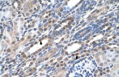 Immunohistochemistry-Paraffin: NOLC1 Antibody [NBP1-58200]