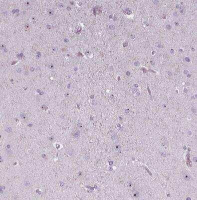 Immunohistochemistry-Paraffin: NOLC1 Antibody [NBP1-83058]