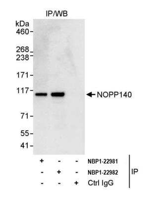 Immunoprecipitation: NOLC1 Antibody [NBP1-22981]