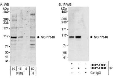 Western Blot: NOLC1 Antibody [NBP1-22982]