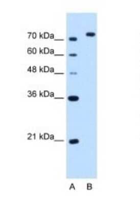 Western Blot: NOLC1 Antibody [NBP1-58200]