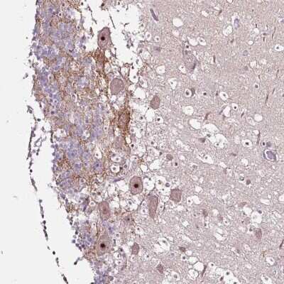 Immunohistochemistry: NOM1 Antibody [NBP2-47352]