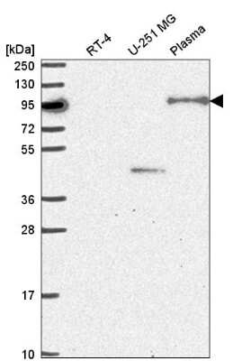 Western Blot: NOM1 Antibody [NBP2-58765]