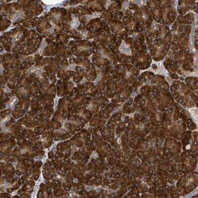 Immunohistochemistry: NOMO1 Antibody [NBP2-46727]