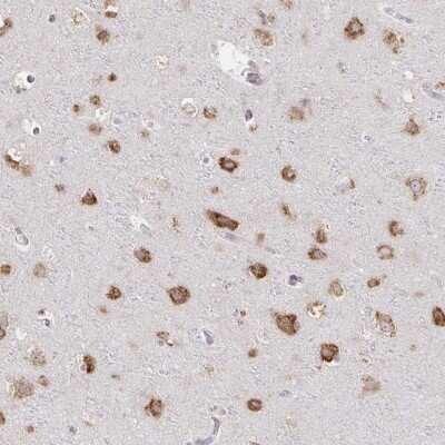 Immunohistochemistry-Paraffin: NOMO1 Antibody [NBP2-46863]