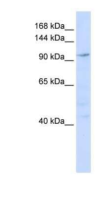 Western Blot: NOMO1 Antibody [NBP1-79565]