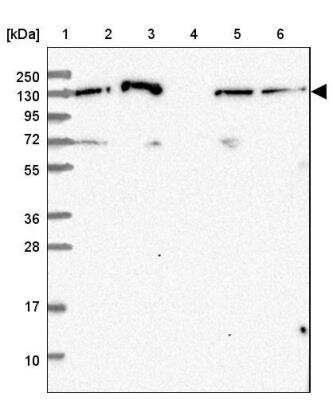 Western Blot: NOMO1 Antibody [NBP2-46727]