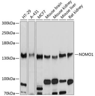 Western Blot: NOMO1 AntibodyBSA Free [NBP2-94166]