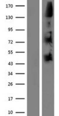 Western Blot: NOMO1 Overexpression Lysate [NBP2-07359]