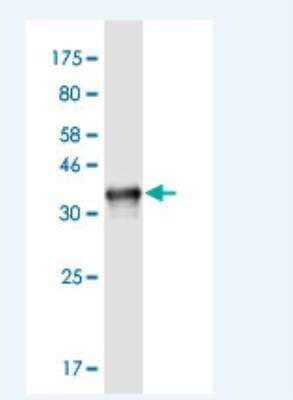 Western Blot: NOMO3 Antibody (5A7) [H00408050-M03-100ug]