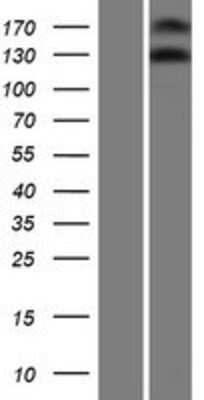 Western Blot: NOMO3 Overexpression Lysate [NBP2-08928]