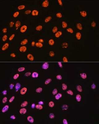 Immunocytochemistry/ Immunofluorescence: NONO Antibody (0V0N8) [NBP3-16276]