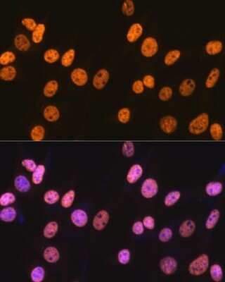 Immunocytochemistry/ Immunofluorescence: NONO Antibody (0V0N8) [NBP3-16276]