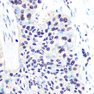 Immunohistochemistry-Paraffin: NONO Antibody (0V0N8) [NBP3-16276]