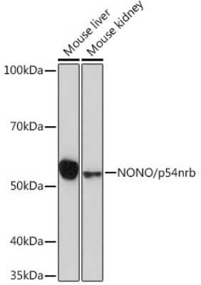 Western Blot: NONO Antibody (0V0N8) [NBP3-16276]