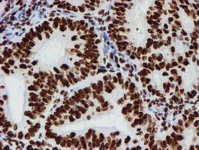 Immunohistochemistry-Paraffin: NONO Antibody (OTI4D9) [NBP2-02060]