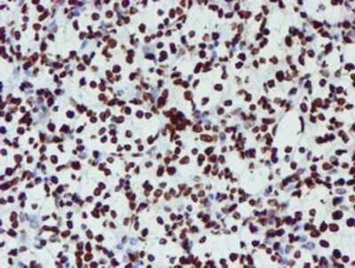 Immunohistochemistry-Paraffin: NONO Antibody (OTI4D9) [NBP2-02060]