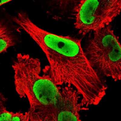 Immunocytochemistry/ Immunofluorescence: NONO Antibody [NBP2-38716]