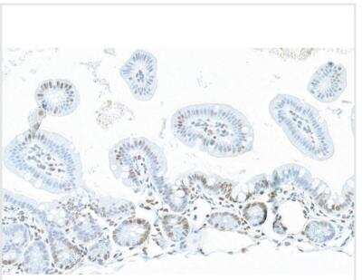 Immunohistochemistry: NONO Antibody [NB100-1556]