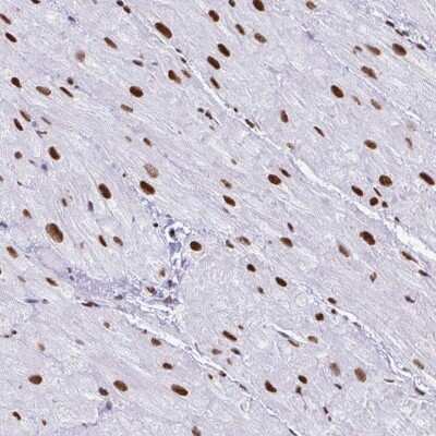Immunohistochemistry: NONO Antibody [NBP2-38716]