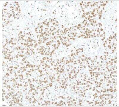 Immunohistochemistry-Paraffin: NONO Antibody [NB100-1556]