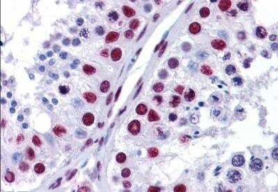 Immunohistochemistry-Paraffin: NONO Antibody [NB100-40789]
