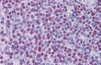 Immunohistochemistry-Paraffin: NONO Antibody [NB100-40789]