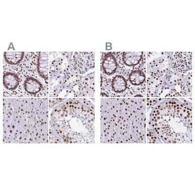 Immunohistochemistry-Paraffin: NONO Antibody [NBP2-38716]