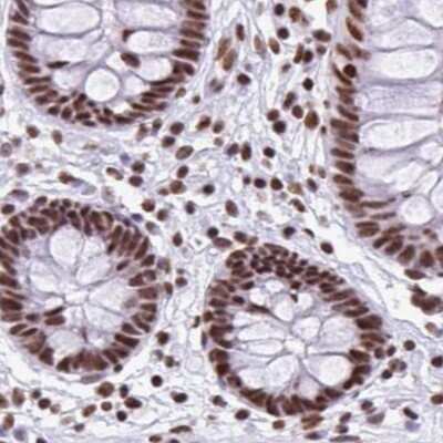 Immunohistochemistry-Paraffin: NONO Antibody [NBP2-38716]