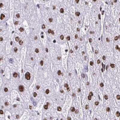Immunohistochemistry-Paraffin: NONO Antibody [NBP2-38716]