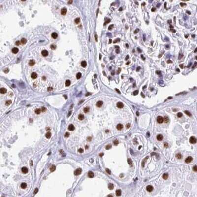 Immunohistochemistry-Paraffin: NONO Antibody [NBP2-38716]