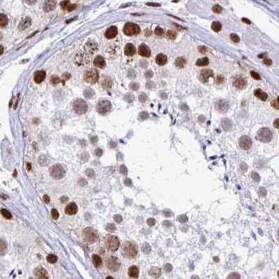 Immunohistochemistry-Paraffin: NONO Antibody [NBP2-38716]