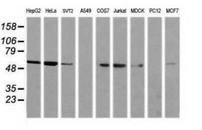 Western Blot: NONO Antibody (OTI3F8)Azide and BSA Free [NBP2-73033]