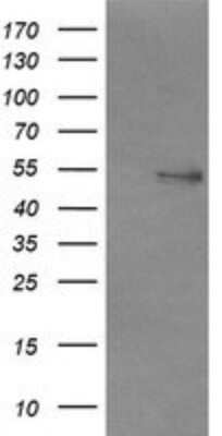 Western Blot: NONO Antibody (OTI3F8)Azide and BSA Free [NBP2-73033]