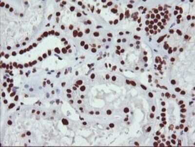 Immunohistochemistry: NONO Antibody (OTI3F8) [NBP2-46194]