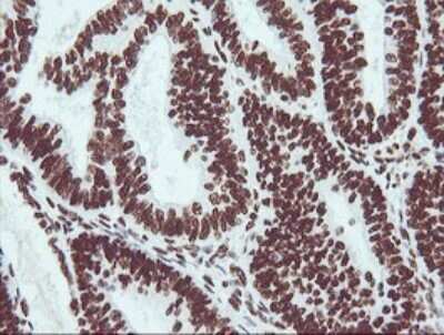Immunohistochemistry: NONO Antibody (OTI3F8) [NBP2-46194]