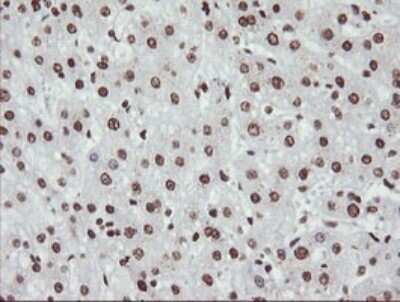 Immunohistochemistry: NONO Antibody (OTI3F8) [NBP2-46194]