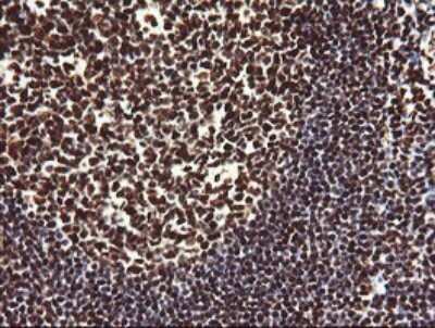 Immunohistochemistry: NONO Antibody (OTI3F8) [NBP2-46194]