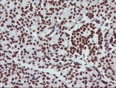 Immunohistochemistry: NONO Antibody (OTI3F8) [NBP2-46194]