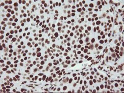 Immunohistochemistry: NONO Antibody (OTI3F8) [NBP2-46194]